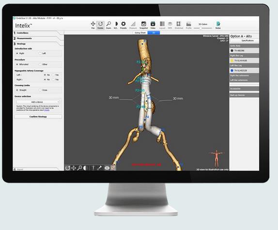 Intelix Procedure Planning Software