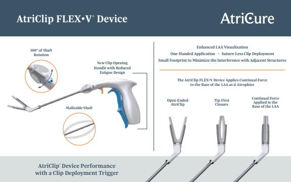AtriClip FLEX•V Device - Brochure