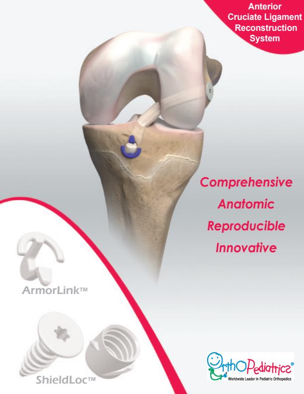 OrthoPediatrics - Model ACL - Reconstruction System - Brochure