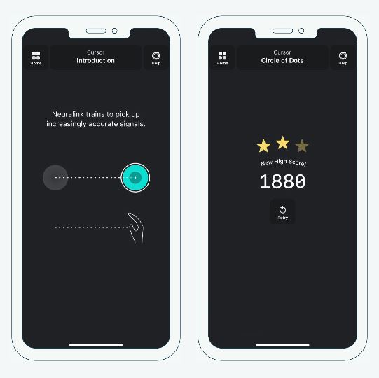 Neuralink Ios Device Control App By Neuralink Medical XPRT