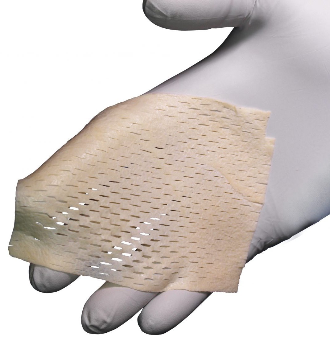 MiroDerm Biologic Wound Matrix by Reprise Biomedical