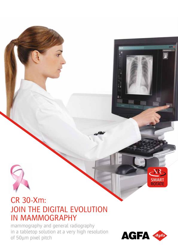Agfa - Model CR 30-Xm - Mammography and General Radiography System ...