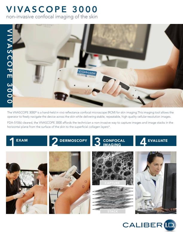 Vivascope - Model 3000 - Handheld Confocal Imaging System - Brochure