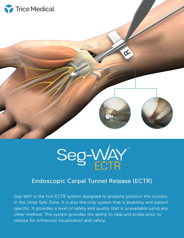 Seg-WAY - Model ECTR - Endoscopic Carpal Tunnel Release System - Brochure