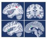 Parasym - Non-Invasive Neuromodulation Device for Mood Enhancement ...
