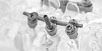 Neuro S.E.S Thoraco-Lumbar Fixation System With Plates or Rods