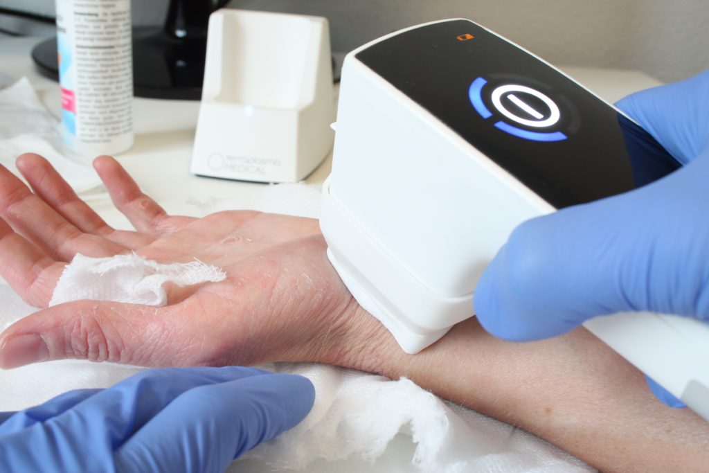 Plasma Derma Care Hightech Handheld For The Treatment Of Skin Diseases
