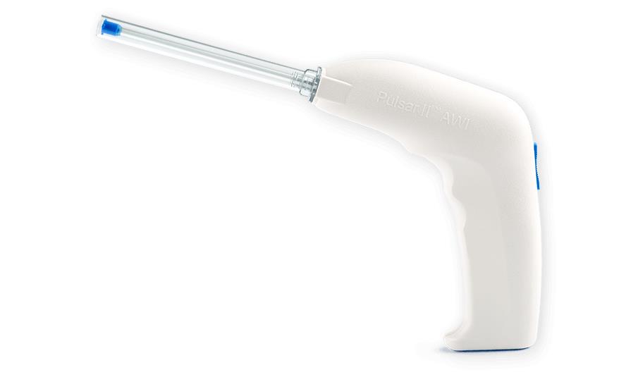 Pulsar II Wound Care Products Advanced Wound Irrigation (AWI