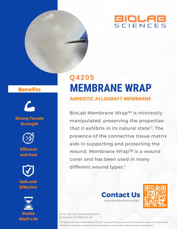 BioLab - Model Membrane Wrap - Amniotic Allograft Membrane Brochure