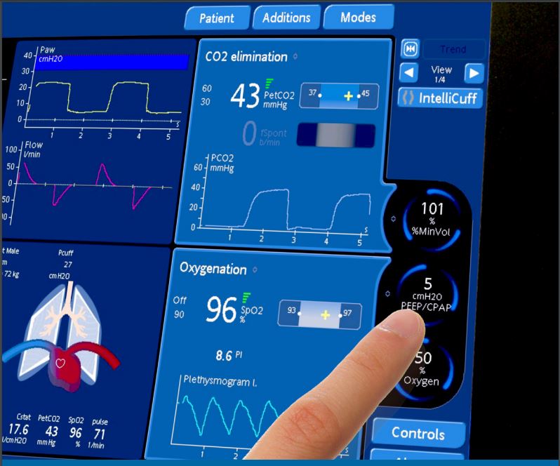 Intellivent ASV Intelligent Ventilation Mode