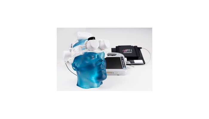 BrainPulse Device for Cranial Motion Measurement