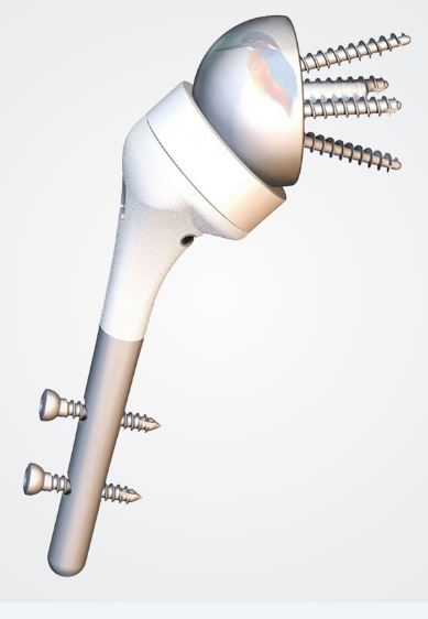 Humelock Reversed - Trauma Products - Trauma Reverse ...
