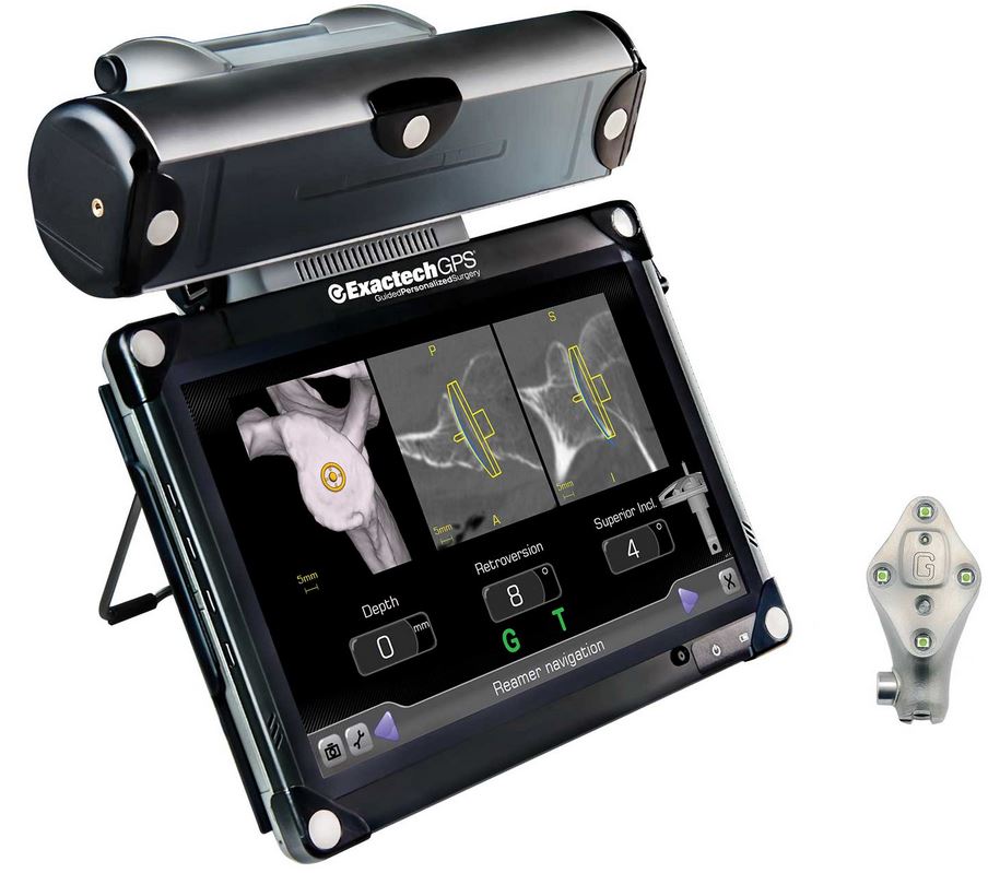 Exactech GPS Guided Personalized Surgery System