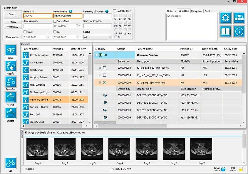 IMAGE iQ-VIEW/PRO Radiology Reading Station Software