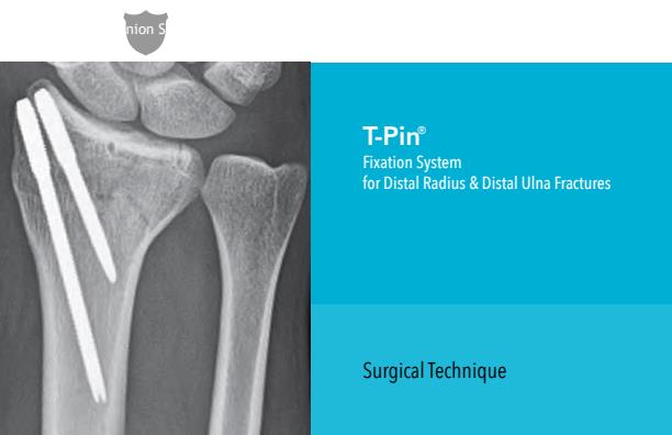 T-Pin - Fixation System for Distal Radius & Distal Ulna Fracture ...