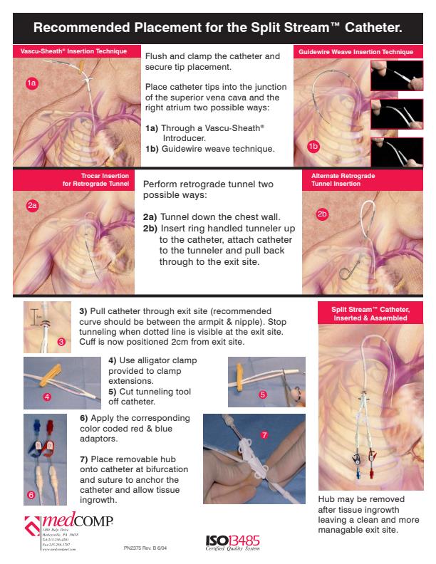 Split Stream - Long Term Hemodialysis Catheter - Brochure