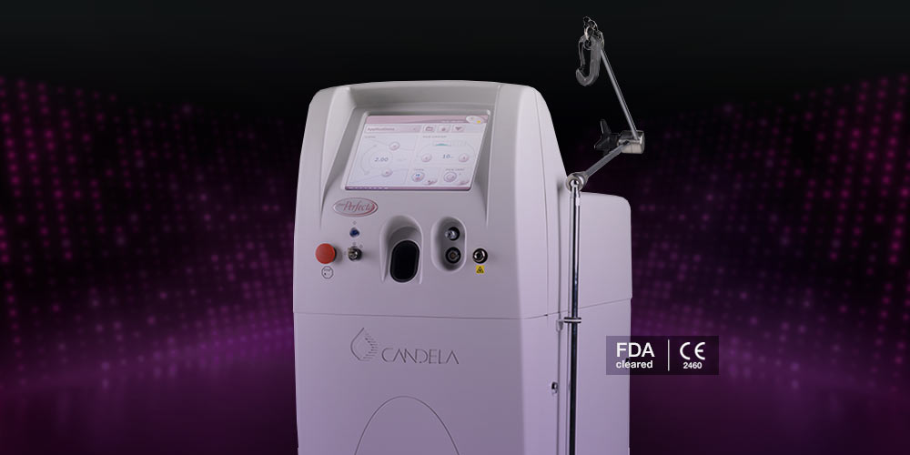 Candela Vbeam Perfecta PulsedDye Lasers (PDL) System by