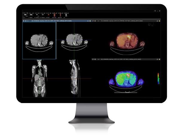 INFINITT PACS Radiology PACS
