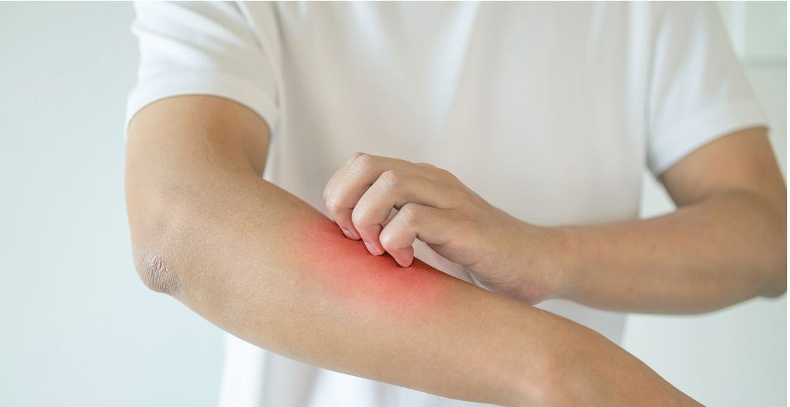 LT5001 Neuroscience Uremic Pruritus by Lumosa