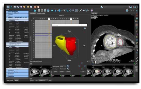 Medis Suite CT Vendor Independent Post Processing Software