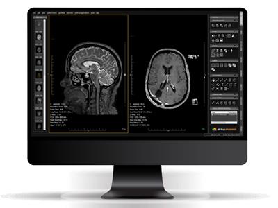 Alma 2D Advanced, Multimodality DICOM Viewer