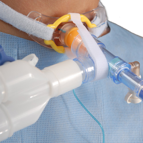 TrachStay Tracheostomy Security Stabilizes Ventilator