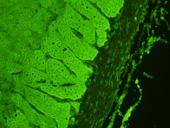 Scimedx Scimedx IFA Autoimmune Assays Adrenal Antibody