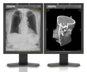 X Med View Diagnostic Console | X Medical Picture