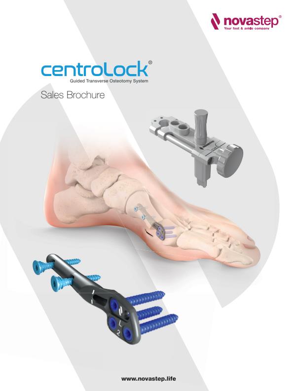 Novastep Centrolock - Guided Transverse Osteotomy System - Brochure