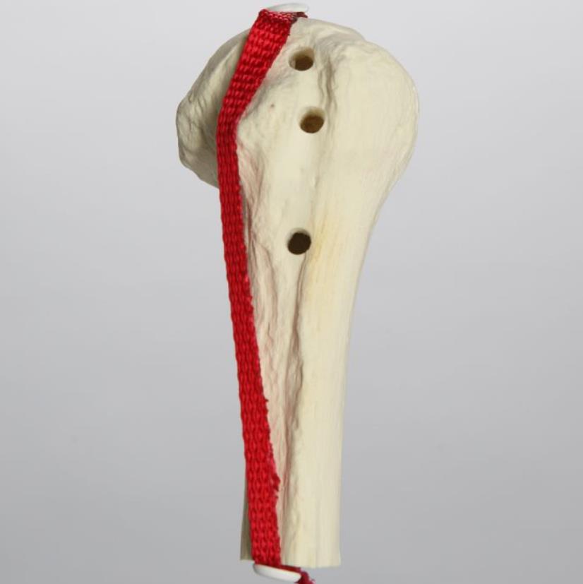 Sawbones 101938 Biceps Tendon Model, Solid Foam By Sawbones