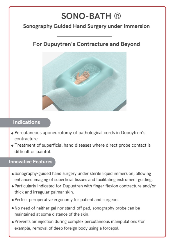 Sono-Bath - Medical Device for Dupuytren’s Contracture Surgery - Brochure