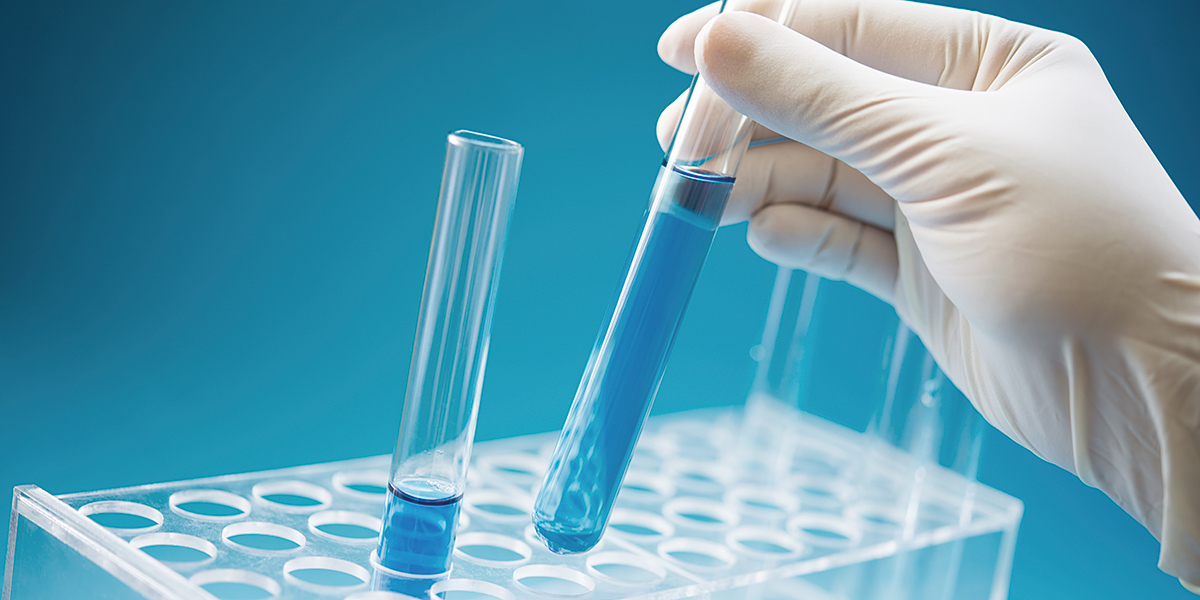 Filtration solutions for chemical applications Chemical